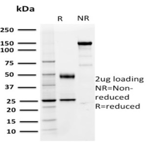 PD-L1单抗SDS—PAGE分析