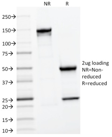 CD22单抗SDS-PAGE分析