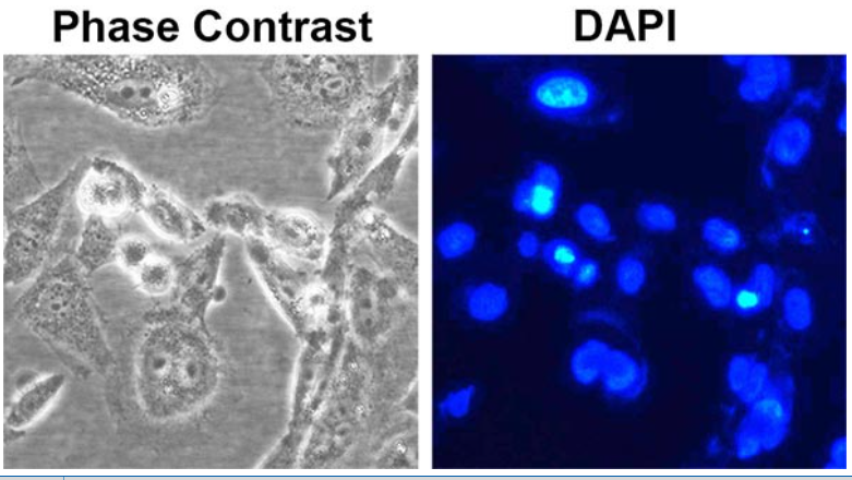 凋亡诱导处理后的HeLa细胞使用Beyotime碧云天抗荧光淬灭封片液含DAPI染色后的效果图