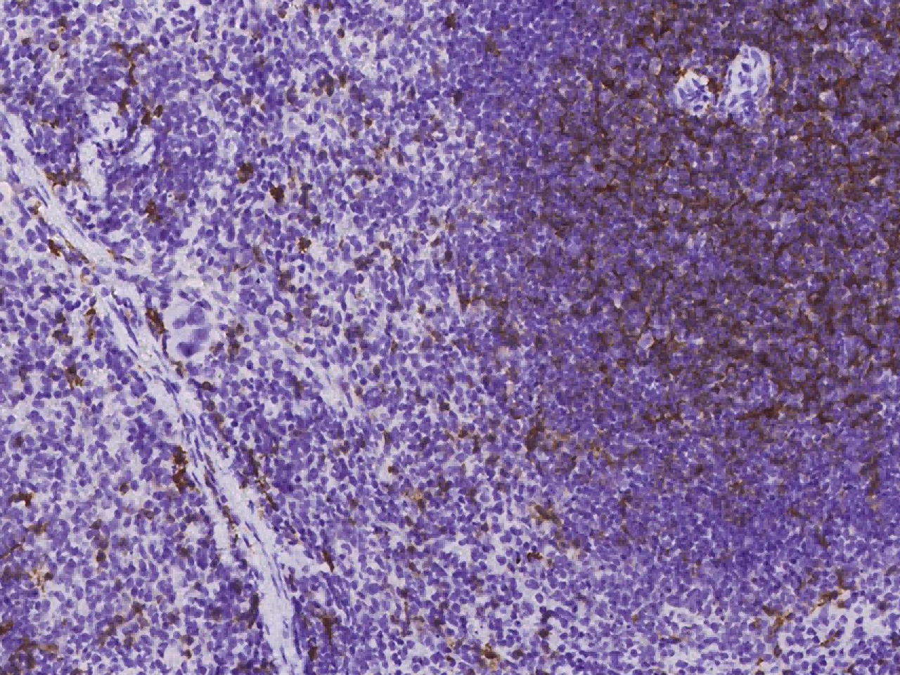 1:200稀释度的兔单克隆抗体免疫染色图