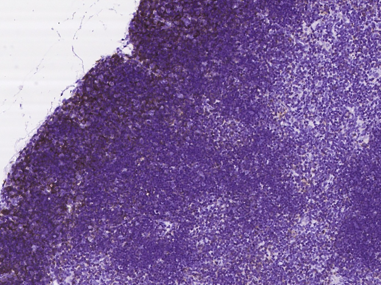 1:300稀释度的兔单克隆抗体对小鼠胸腺中的小鼠CD8 α免疫染色图